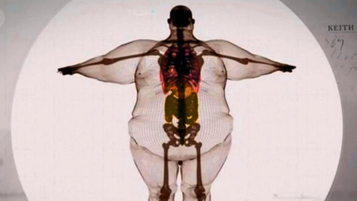 Широкая кость лица. Рентген Толстого человека. Рентген человека с широкой костью.